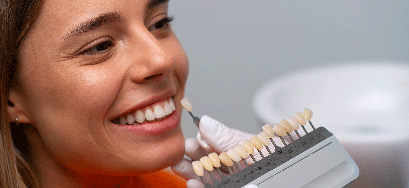 Cos'è la lamina dentale?