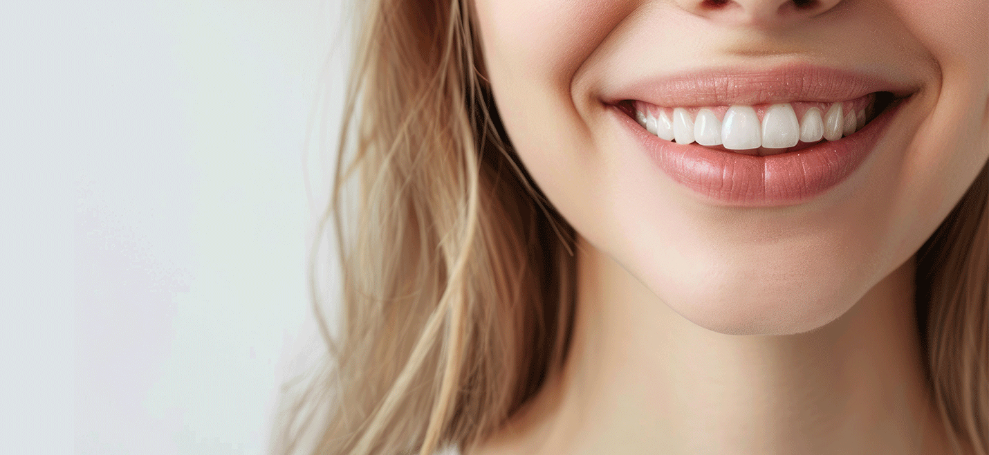 Cos'è un sorriso hollywoodiano?