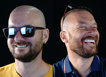 Before-After-6